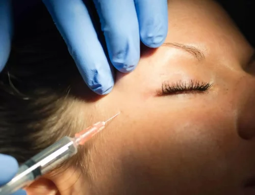 Acide hyaluronique : ce que le traitement fait vraiment à votre peau