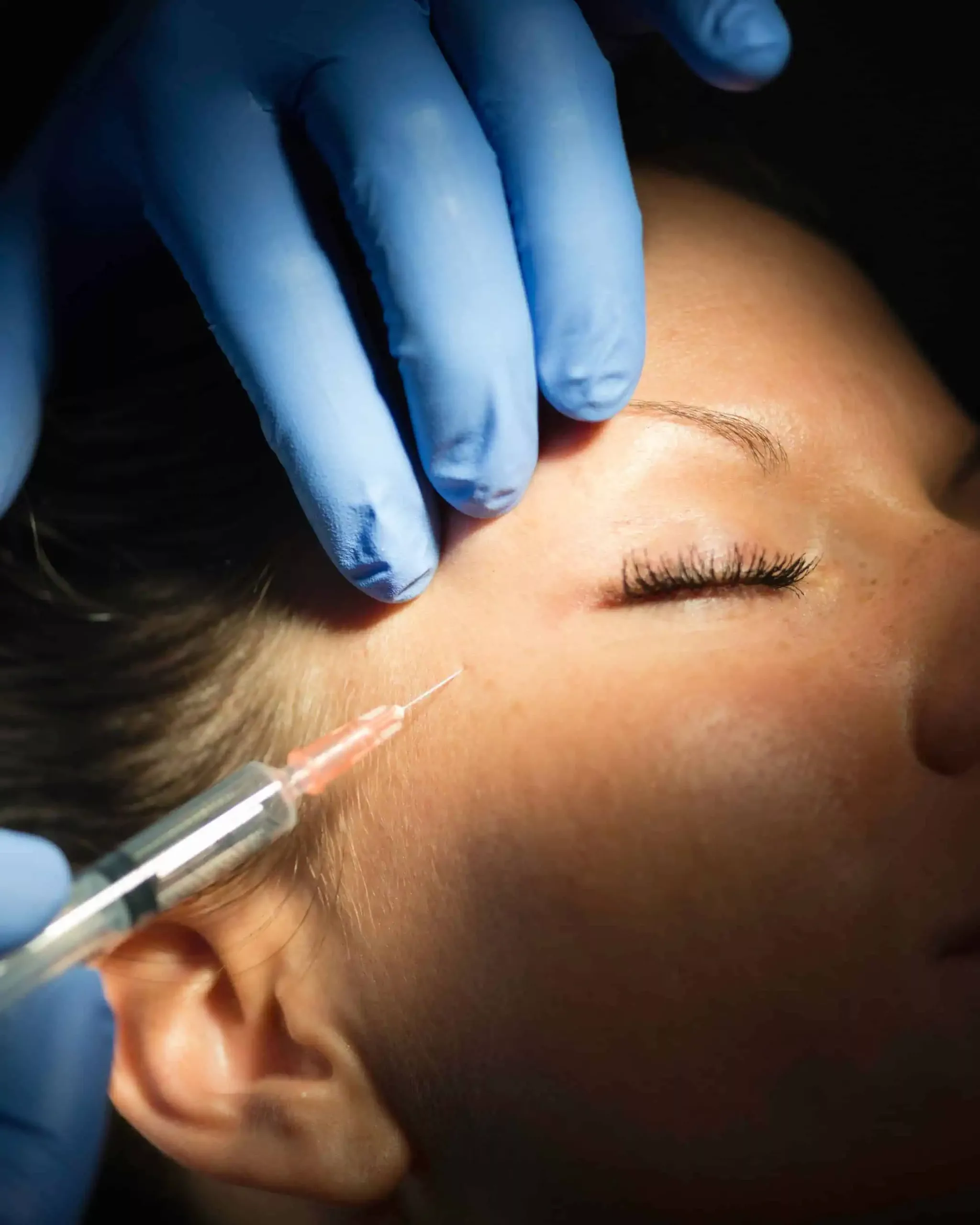Gros plan d'une personne aux yeux fermés avec de longs cils recevant une injection près de la tempe, une main gantée bleue maintenant la peau tandis qu'une seringue à fine aiguille s'approche.